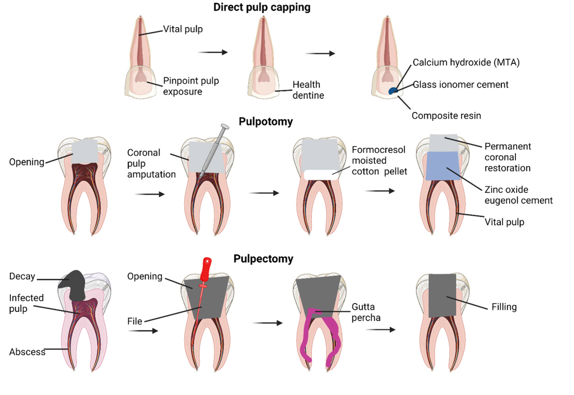 Dental Pulp Stem Cells: Biology and Promise for Regenerative Medicine -  International Journal of Pharmaceutical Investigation